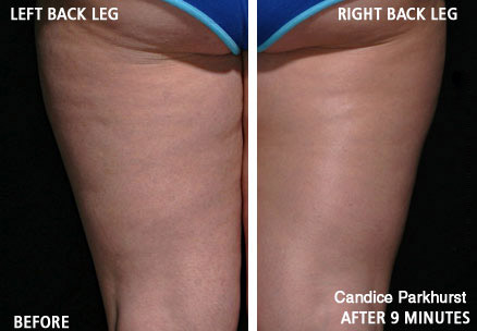 Candince Parkhurst - age 27