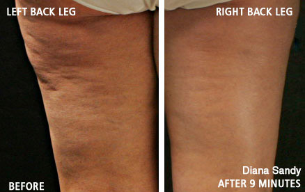 Diana Sandy - age 60