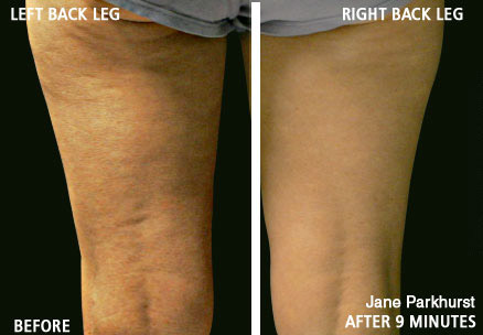 Jane Parkhurst - age 51