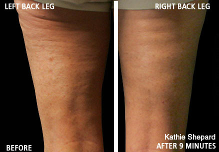 Kathie Shepard - age 48