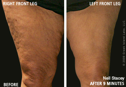 Nell Stacey - age 64