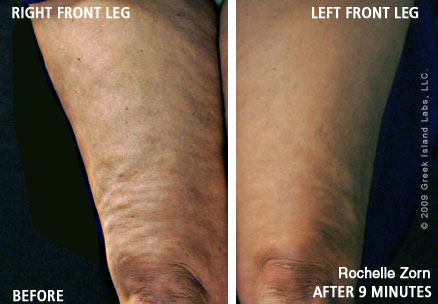 Rochelle Zorn - age 45